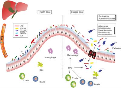 Molecular Immune Mechanism of Intestinal Microbiota and Their Metabolites in the Occurrence and Development of Liver Cancer